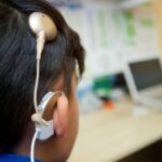 IMSS debe cubrir implantes cocleares para menores: Declaratoria sectorial